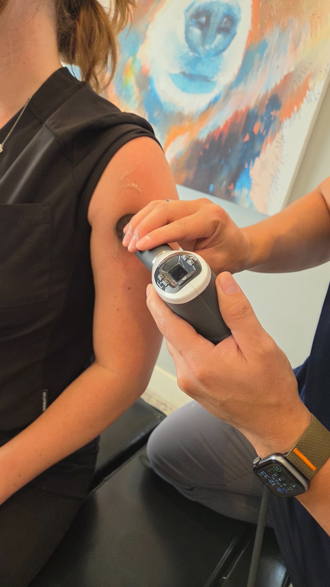 Shoulder Tendon Calcification treatment using STORZ shockwave equipment